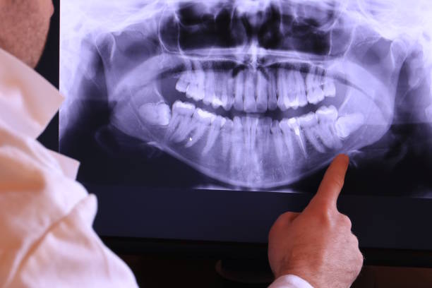 Best Emergency Tooth Extraction in Statham, GA