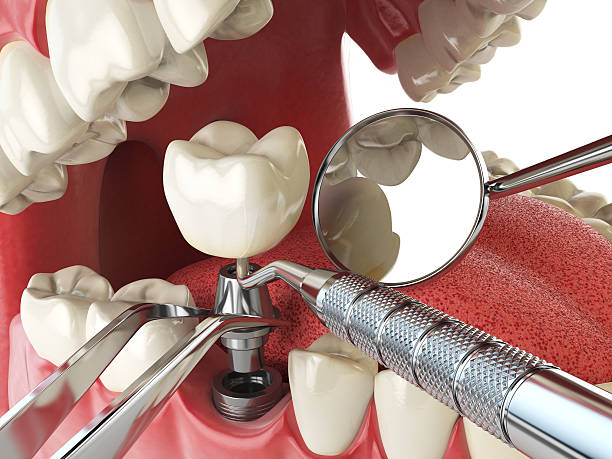 Best Emergency Tooth Extraction in Statham, GA